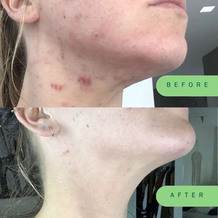 Skin Nutritious • holistic acne clinic Picture 10