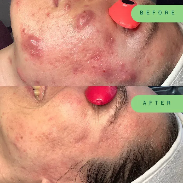 Skin Nutritious • holistic acne clinic Picture 9