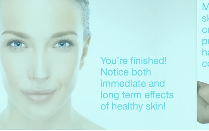 Skin on Market Picture 7