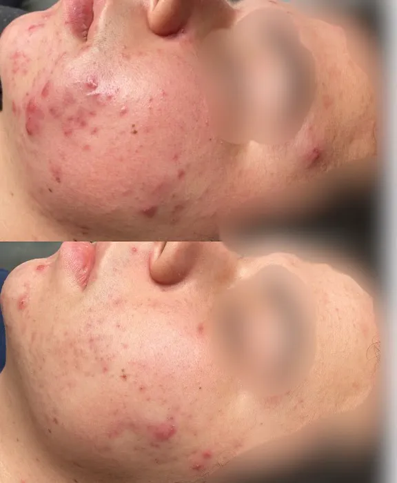 The Beez Kneez Skin Care & Acne Clinic Picture 7