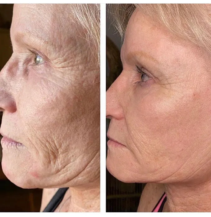 Captulina Skincare Picture 3