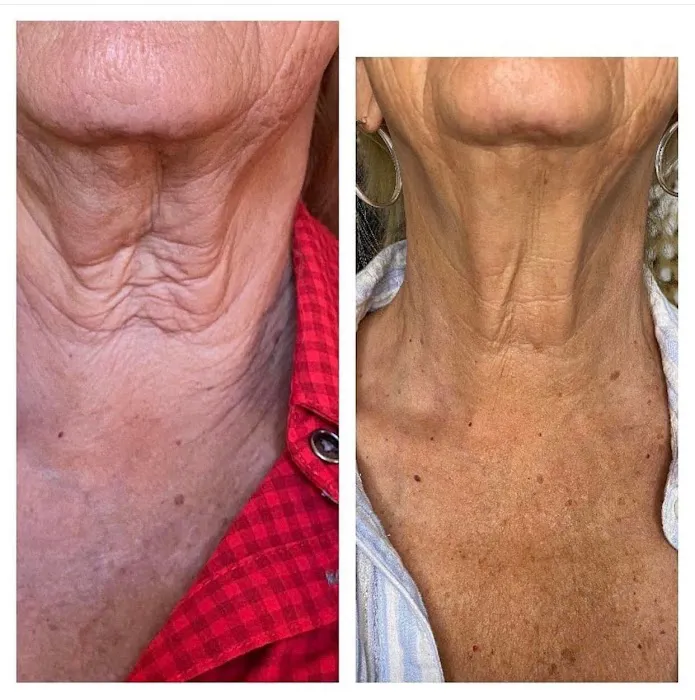 Captulina Skincare Picture 1