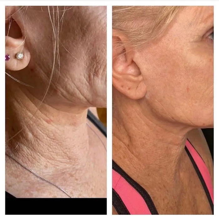 Captulina Skincare Picture 2