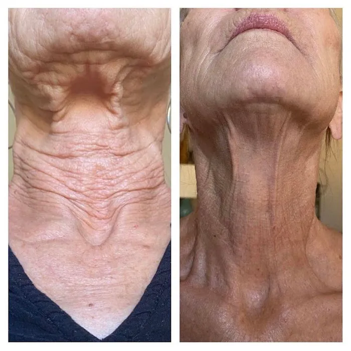 Captulina Skincare Picture 4