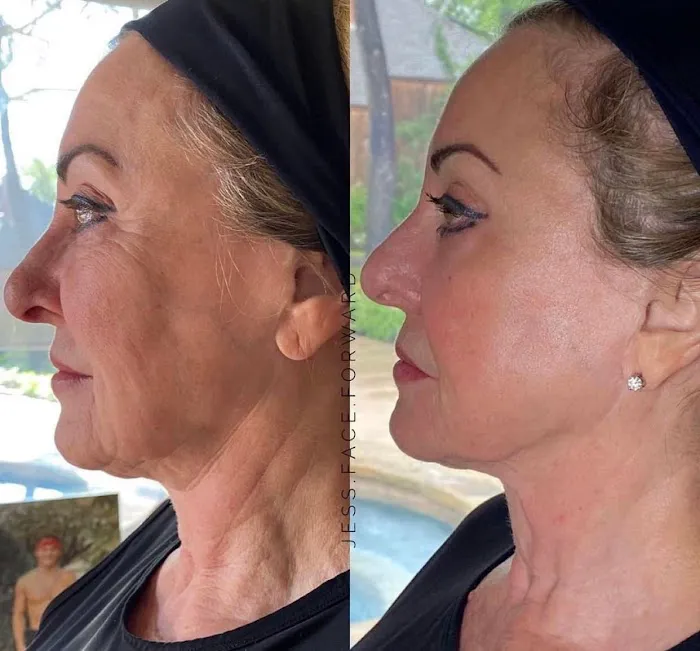 Captulina Skincare Picture 5