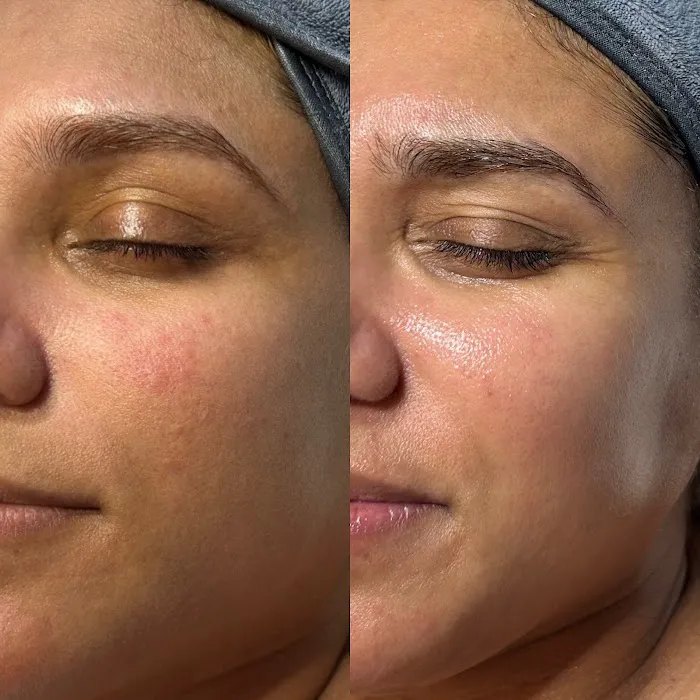 The Beauty Pro Picture 2