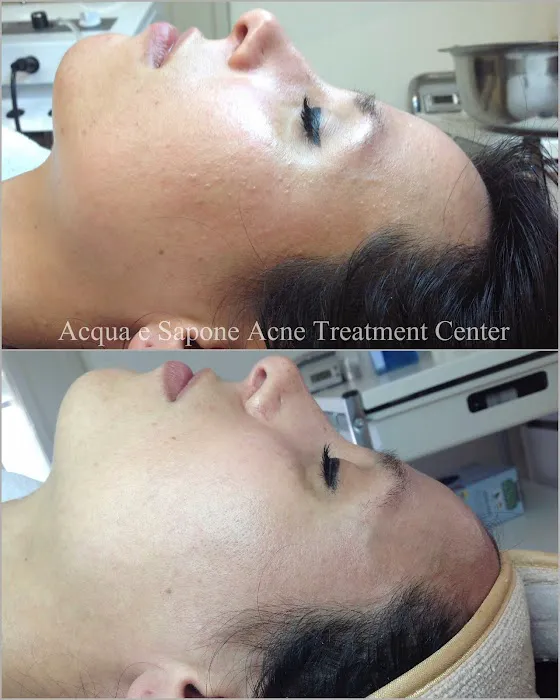AES Acne Clinic Picture 3