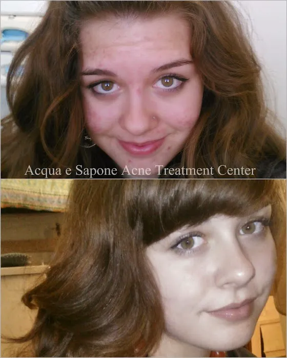 AES Acne Clinic Picture 6