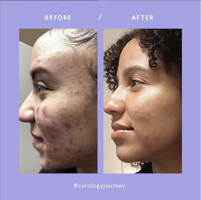 Curology, Inc. Picture 7