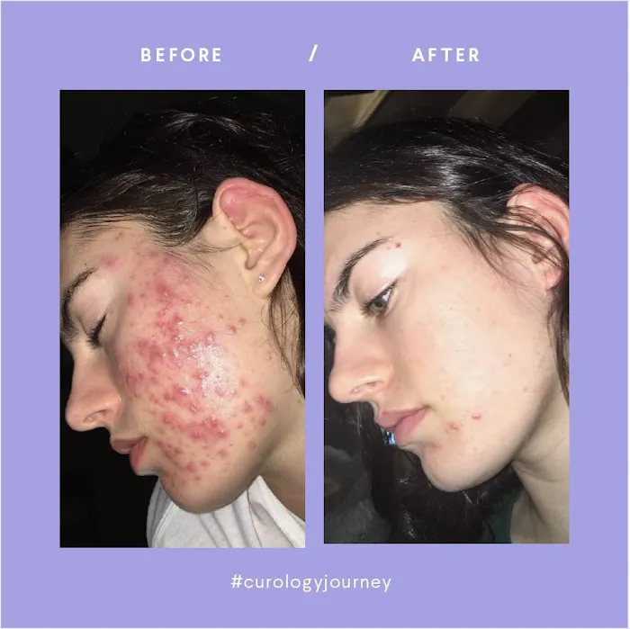 Curology, Inc. Picture 9