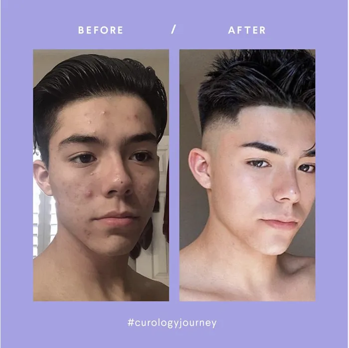 Curology, Inc. Picture 8