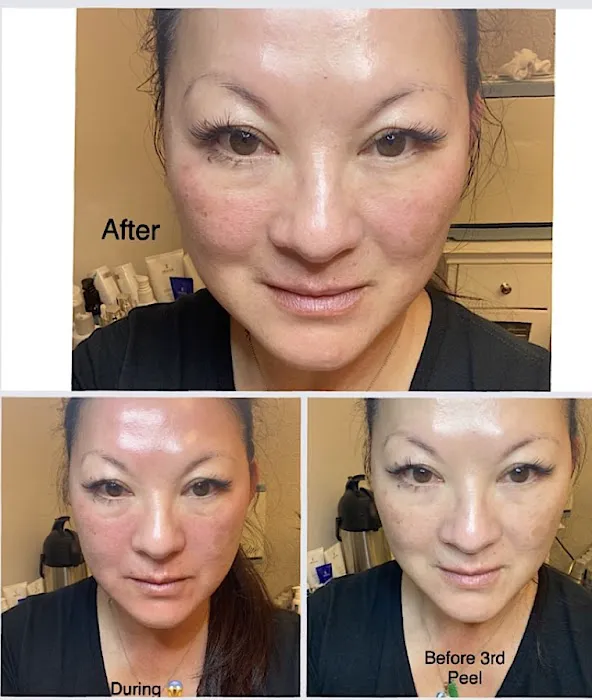 Skin by Lisa Picture 3