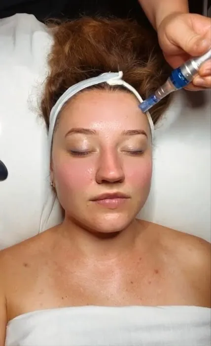 Skin by Lisa Picture 10