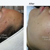 La Petite Rose skincare & acne solution ico