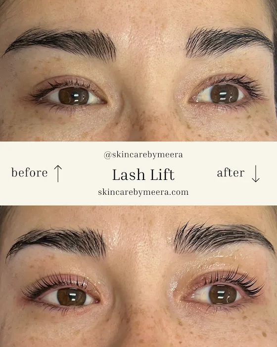 Skin Care By Meera Picture 7