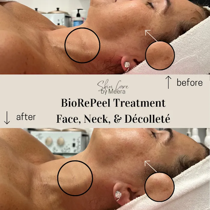 Skin Care By Meera Picture 8