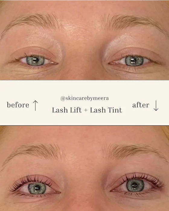 Skin Care By Meera Picture 9