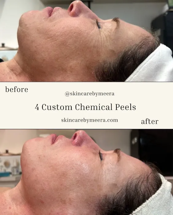 Skin Care By Meera Picture 10