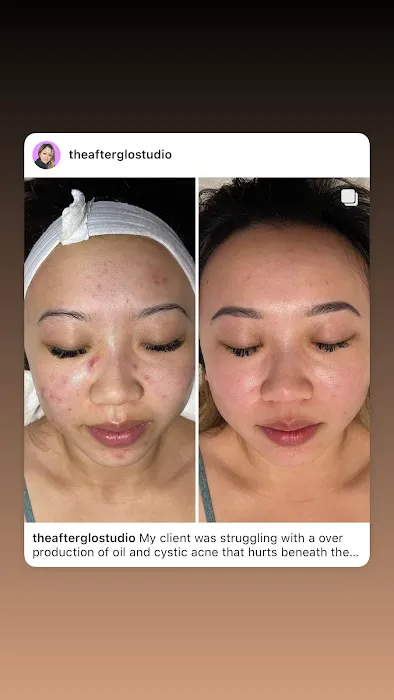 After Glo Beauty Collective Picture 2