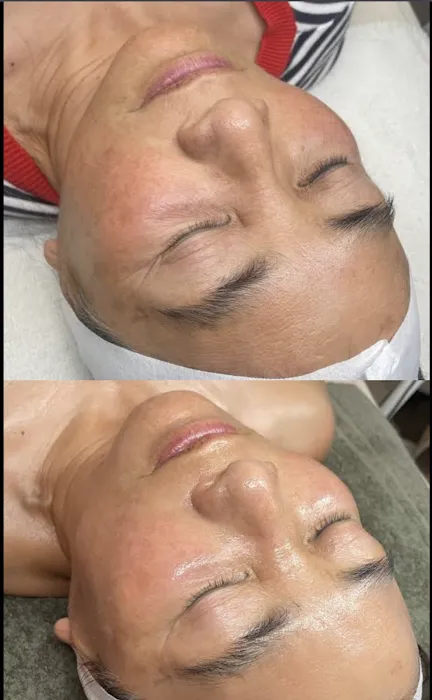 After Glo Beauty Collective Picture 3