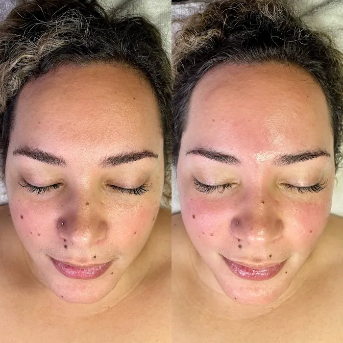 After Glo Beauty Collective Picture 8