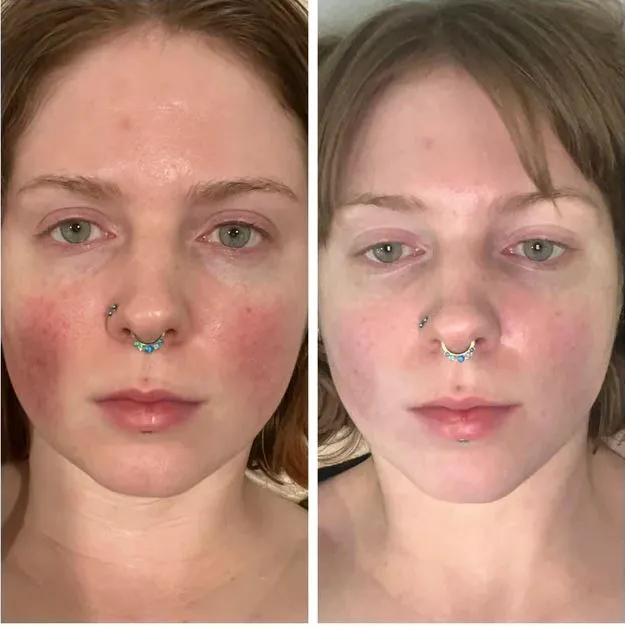 Skin Foundry Picture 5