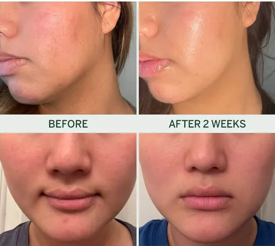 Skin Foundry Picture 6