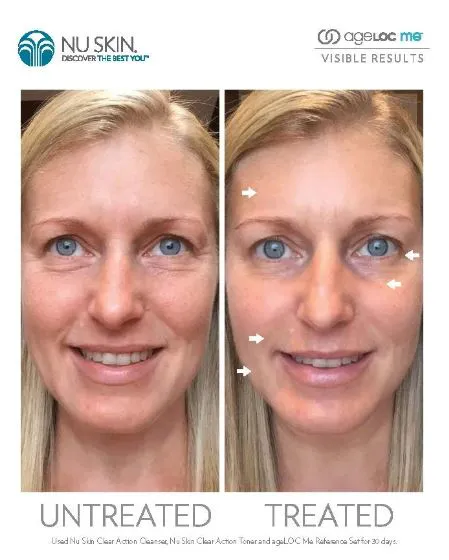 Skin Foundry Picture 7