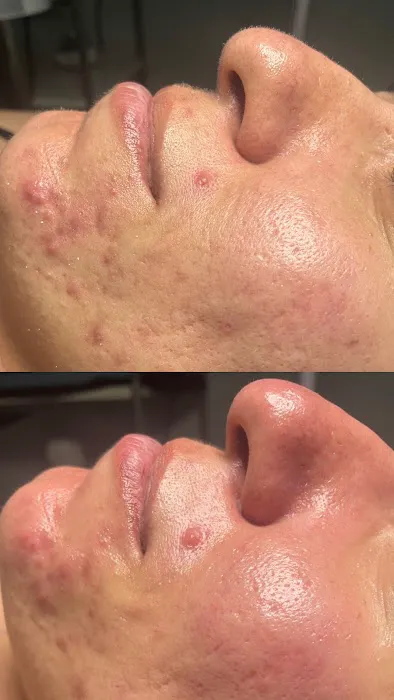 Hyde Park Esthetics Picture 2