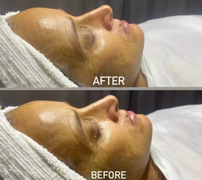 Inara Aesthetics & Beauty Bar Picture 2