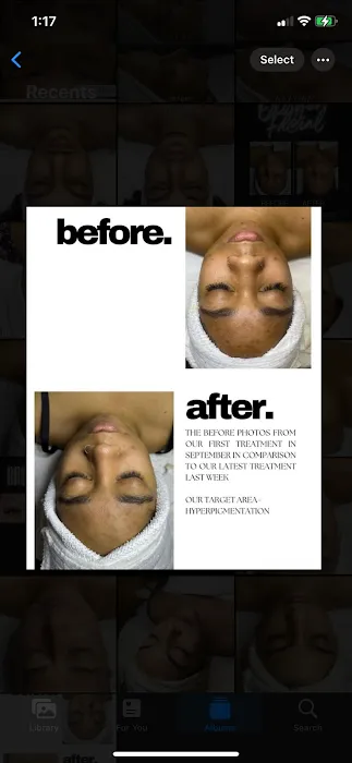 Inara Aesthetics & Beauty Bar Picture 10