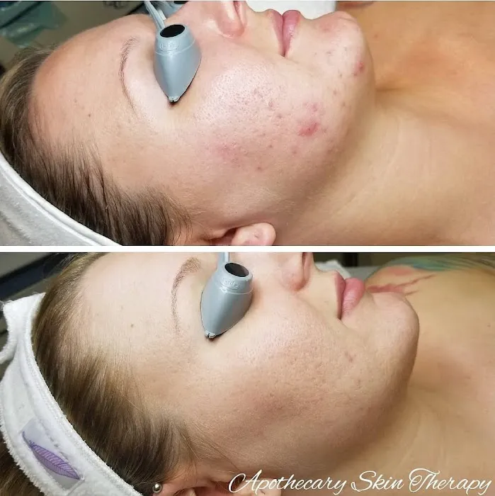 Apothecary Skin Therapy Picture 6