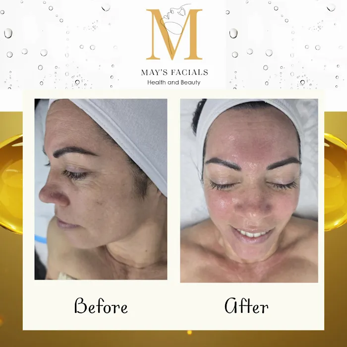 May's Facials Picture 7
