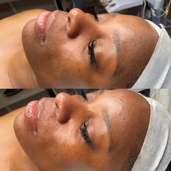 Sol Y Luna Skin Picture 1