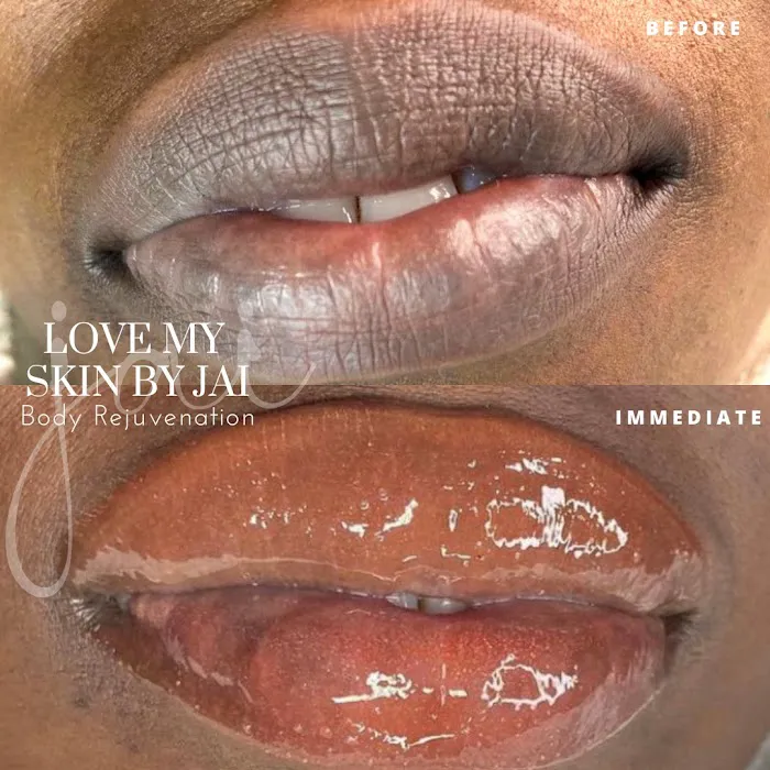 Love My Skin By Jai Picture 2