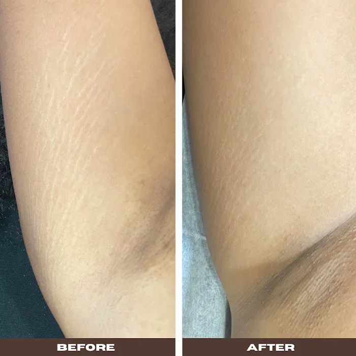 Love My Skin By Jai Picture 4