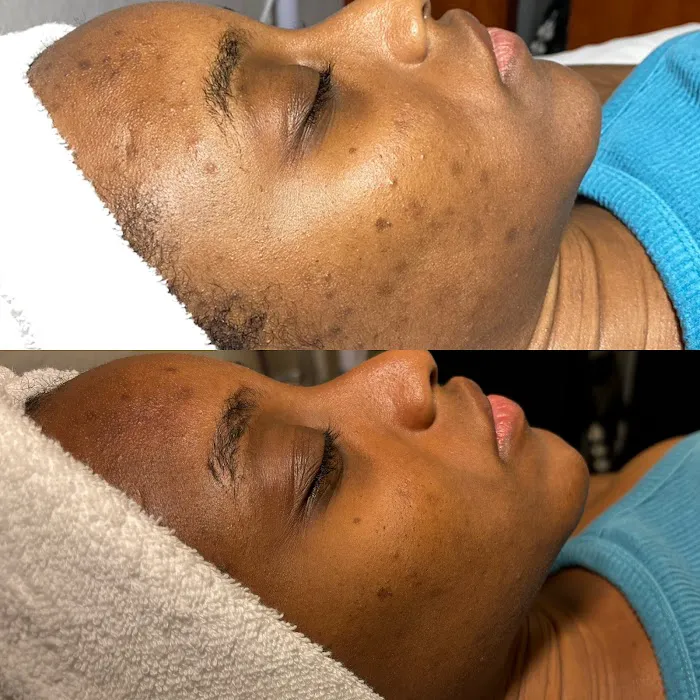 LS Aesthetic Studio Picture 8