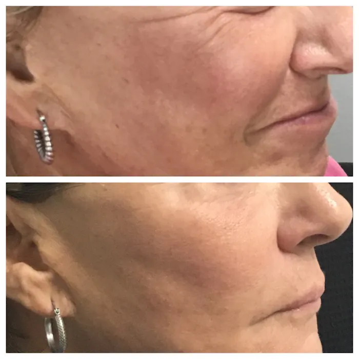 MB Aesthetics Picture 3