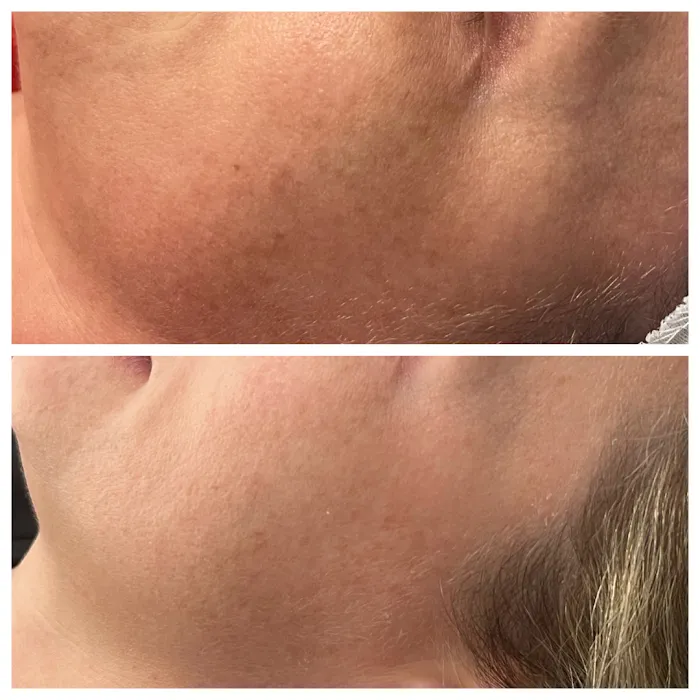 MB Aesthetics Picture 4