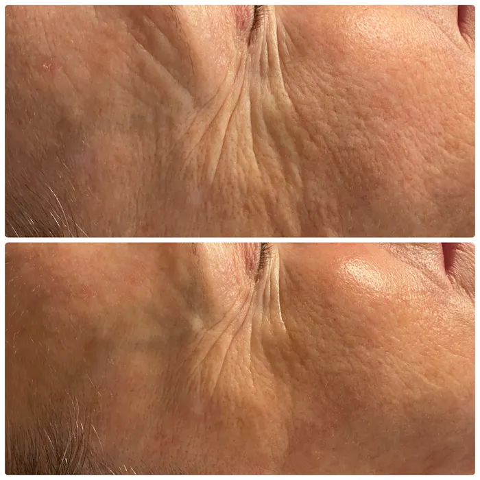 MB Aesthetics Picture 5