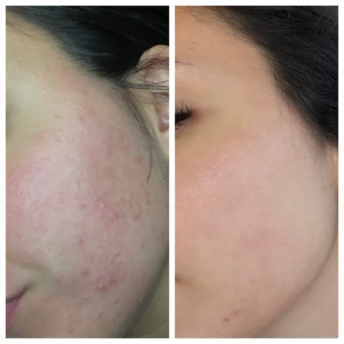 MB Aesthetics Picture 7