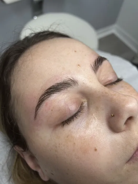 Bhodi Skin Picture 1