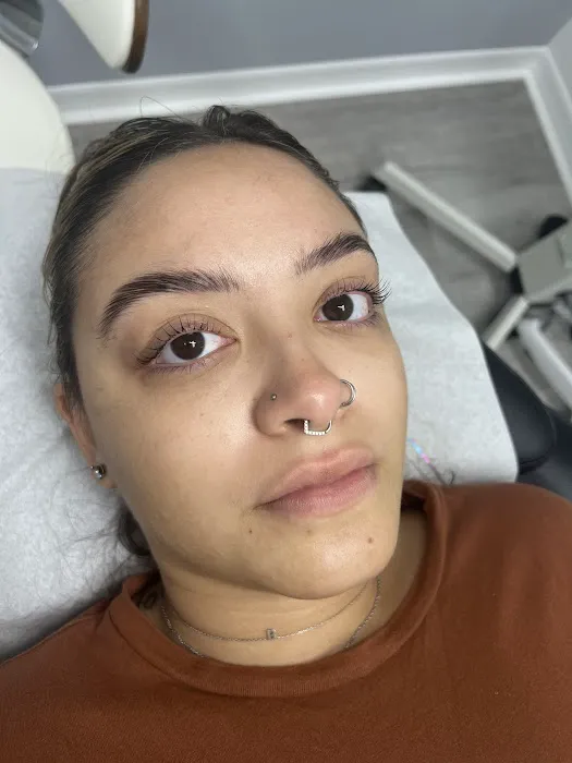 Bhodi Skin Picture 6