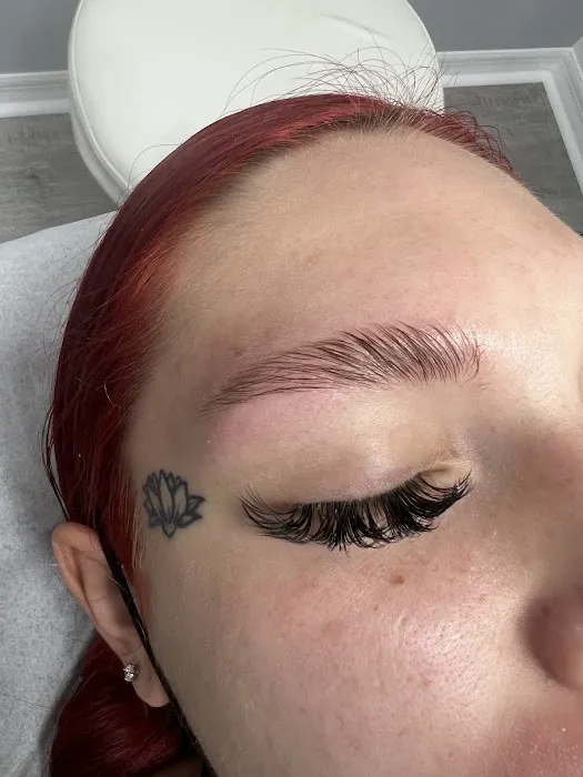 Bhodi Skin Picture 7