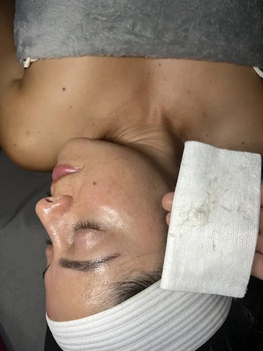 Bhodi Skin Picture 10