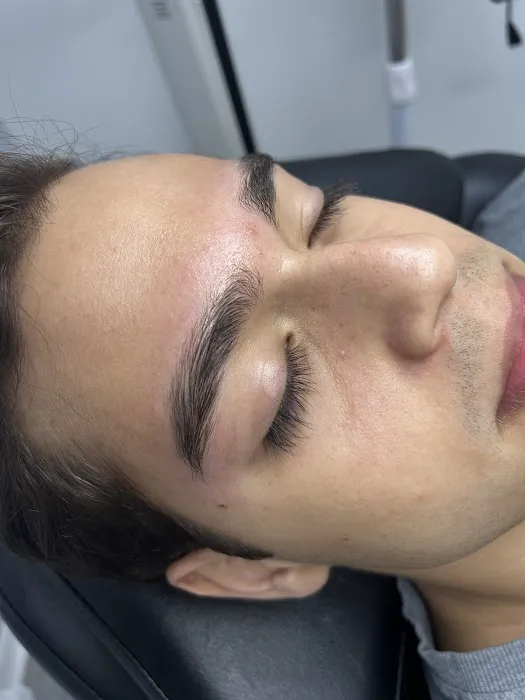 Bhodi Skin Picture 9