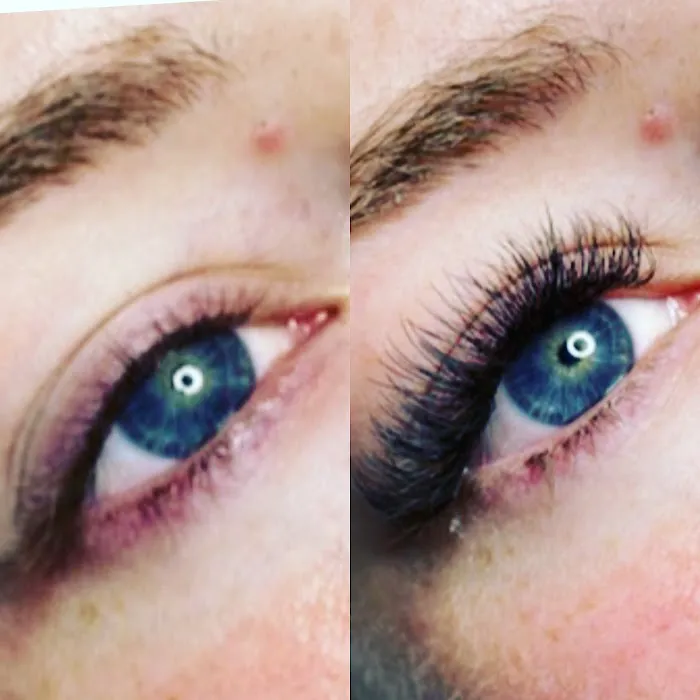 Amiés Aesthetics Picture 2