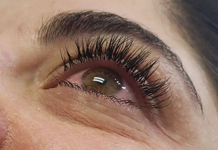 Amiés Aesthetics Picture 1