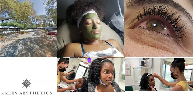 Amiés Aesthetics Picture 7