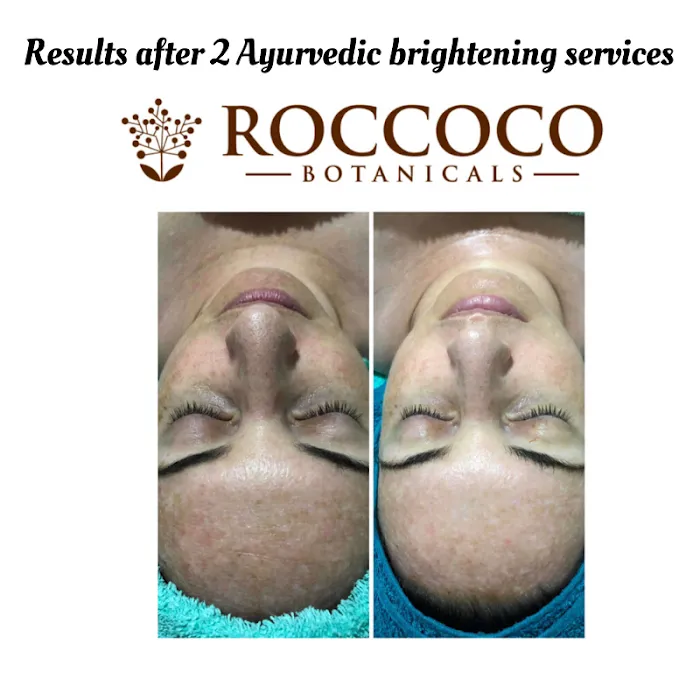 Holistic Skin Care Tampa Picture 8